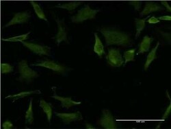 RhoA Antibody (1C3), Novus Biologicals 0.1 mg | Buy Online | Novus Biologicals | Fisher Scientific