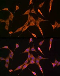 RhoC Rabbit anti-Human, Mouse, Rat, Clone: 7X5I9, Novus Biologicals 100