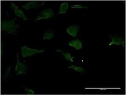 RhoC Antibody (1B7), Novus Biologicals 0.1 mg | Buy Online | Novus Biologicals | Fisher Scientific