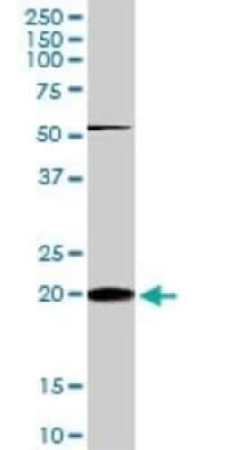 RhoC Antibody (2E12), Novus Biologicals 0.1 mg, Unconjugated:Antibodies,