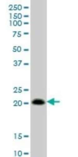 RhoC Antibody (2E12), Novus Biologicals 0.1 mg, Unconjugated:Antibodies,