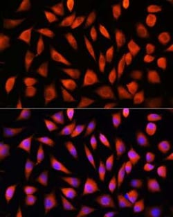 RhoG Rabbit anti-Human, Mouse, Rat, Polyclonal, Novus Biologicals 20 &mu;g | Buy Online | Bio-Techne | Fisher Scientific