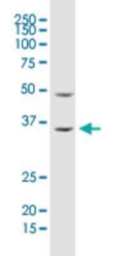 RhoGDI Antibody (1G5-2F3), Novus Biologicals 0.1 mg | Buy Online | Novus Biologicals | Fisher Scientific