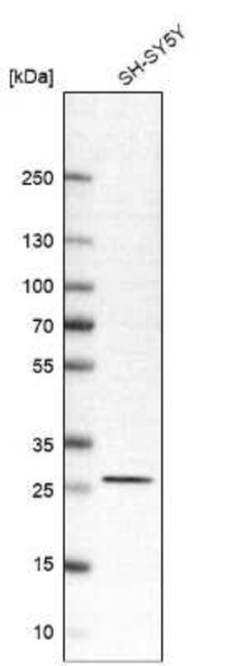 RhoGDI Antibody, Novus Biologicals 0.1 mL | Buy Online | Novus Biologicals | Fisher Scientific