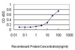 RhoJ Antibody (1E4), Novus Biologicals 0.1 mg; Unconjugated:Antibodies,