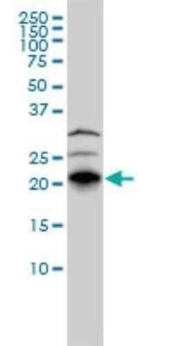 RhoJ Antibody (1E4), Novus Biologicals 0.1 mg; Unconjugated:Antibodies,