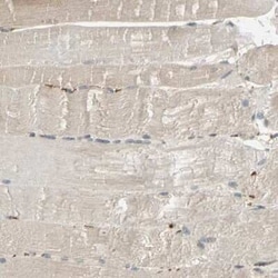 Ribophorin II Antibody, Novus Biologicals 0.1 mL; Unconjugated:Antibodies,