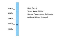 Ribosomal Protein L24 Rabbit anti-Human, Polyclonal, Novus Biologicals
