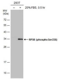 Ribosomal Protein S6/RPS6, p Ser235 Antibody (GT829), Novus Biologicals