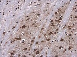 Ribosomal Protein S6/RPS6, p Ser235 Antibody, Novus Biologicals 100 &mu;g | Buy Online | Novus Biologicals | Fisher Scientific