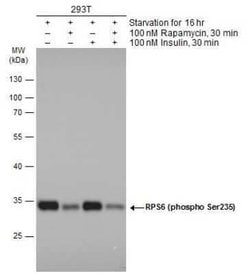 Ribosomal Protein S6/RPS6, p Ser235 Antibody, Novus Biologicals 100 &mu;g | Buy Online | Novus Biologicals | Fisher Scientific