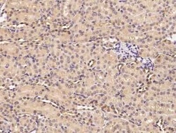Ribosome maturation protein SBDS Antibody, Novus Biologicals 50 &mu;g,