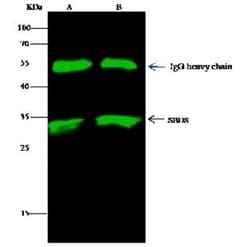 Ribosome maturation protein SBDS Antibody, Novus Biologicals 50 &mu;g,