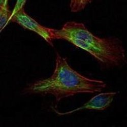 Rictor Antibody (7B3) - Azide and BSA Free, Novus Biologicals 0.1 mL; Unconjugated:Antibodies,