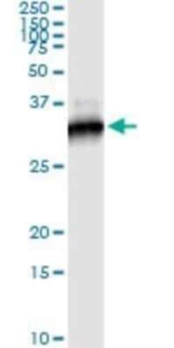 Rictor Antibody (1F3), Novus Biologicals 0.1 mg | Buy Online | Novus Biologicals | Fisher Scientific