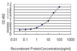 Rictor Antibody (1F3), Novus Biologicals 0.1 mg | Buy Online | Novus Biologicals | Fisher Scientific