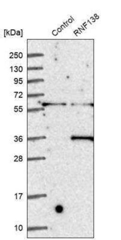 Ring finger protein 138 Antibody, Novus Biologicals:Antibodies:Primary