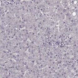 Rit2 Antibody, Novus Biologicals 25ul; Unconjugated:Antibodies, Polyclonal