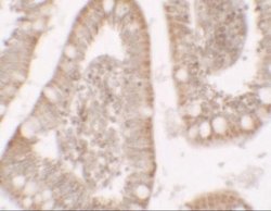Roquin Antibody - BSA Free, Novus Biologicals 0.1 mg; Unconjugated:Antibodies,