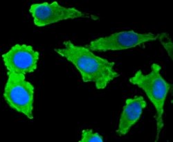 S100B Antibody (SC57-02), Novus Biologicals 100&mu;L:Antibodies, Monoclonal