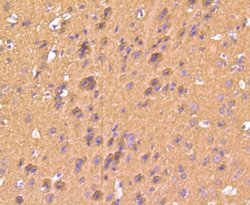 S100B Antibody (SC57-02), Novus Biologicals 100&mu;L:Antibodies, Monoclonal