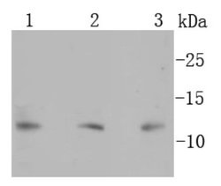 S100B Antibody (SC57-02), Novus Biologicals 100&mu;L:Antibodies, Monoclonal