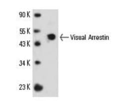 S-arrestin Antibody (PDS-1) - Azide and BSA Free, Novus Biologicals 0.1