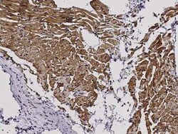 S100A1 Rabbit anti-Mouse, Clone: 4, Novus Biologicals 100 &mu;g; Unconjugated:Antibodies,