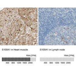 S100A1 Antibody, Novus Biologicals 25 &mu;L; Unconjugated:Antibodies, Polyclonal