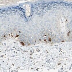 S100A1 Antibody, Novus Biologicals 25 &mu;L; Unconjugated:Antibodies, Polyclonal