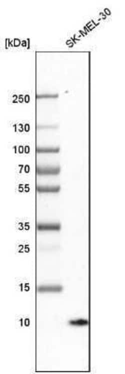 S100A1 Antibody, Novus Biologicals 25 &mu;L; Unconjugated:Antibodies, Polyclonal