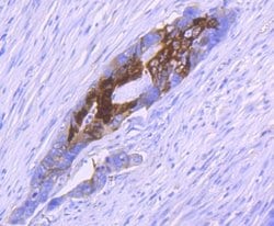 S100A10 Rabbit anti-Human, Clone: JF0987, Novus Biologicals 100&mu;L:Antibodies,