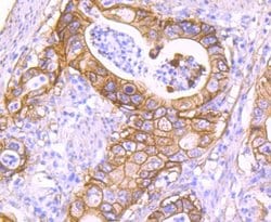 S100A10 Rabbit anti-Human, Clone: JF0987, Novus Biologicals 100&mu;L:Antibodies,
