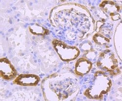 S100A10 Rabbit anti-Human, Clone: JF0987, Novus Biologicals 100&mu;L:Antibodies,