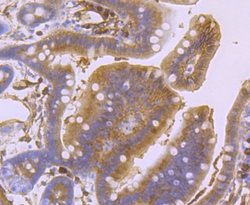 S100A10 Rabbit anti-Human, Clone: JF0987, Novus Biologicals 100&mu;L:Antibodies,