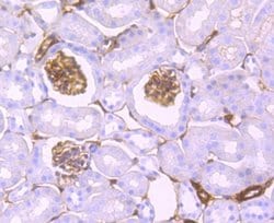 S100A10 Rabbit anti-Human, Clone: JF0987, Novus Biologicals 100&mu;L:Antibodies,