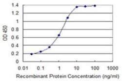 S100A11 Antibody (1B12), Novus Biologicals 0.1 mg | Buy Online | Novus Biologicals | Fisher Scientific
