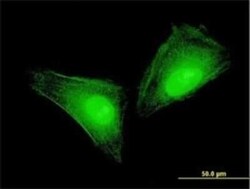 S100A11 Antibody (2F4), Novus Biologicals 0.1 mg | Buy Online | Novus Biologicals | Fisher Scientific