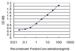 S100A11 Antibody (2F4), Novus Biologicals 0.1 mg | Buy Online | Novus Biologicals | Fisher Scientific