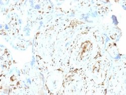 S100A2 Antibody (CPTC-S100A2-2) - Azide and BSA Free, Novus Biologicals