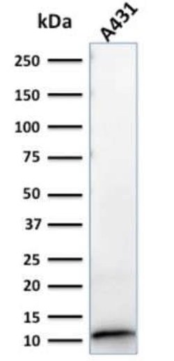 S100A2 Antibody (CPTC-S100A2-2) - Azide and BSA Free, Novus Biologicals
