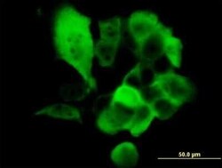 S100A2 Antibody (3H8), Novus Biologicals 100 &mu;g | Buy Online | Novus Biologicals | Fisher Scientific
