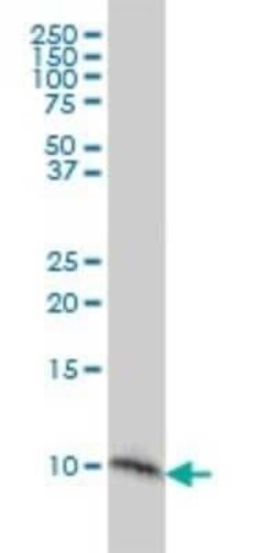 S100A2 Antibody (3H8), Novus Biologicals 100 &mu;g | Buy Online | Novus Biologicals | Fisher Scientific