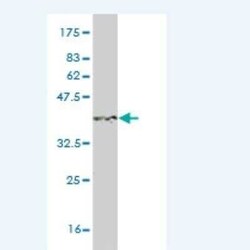 S100A3 Antibody (1D4), Novus Biologicals 0.1 mg | Buy Online | Novus Biologicals | Fisher Scientific