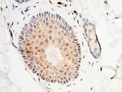 S100A3 Antibody, Novus Biologicals 50 &mu;g; Unconjugated:Antibodies, Polyclonal