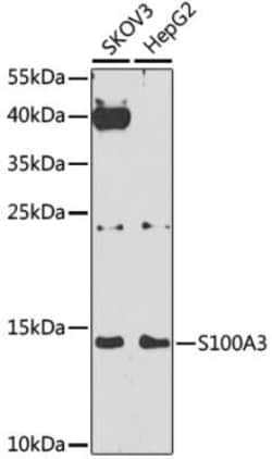 S100A3 Antibody - BSA Free, Novus Biologicals 0.1 mL; Unconjugated:Antibodies,