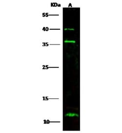 S100A3 Antibody, Novus Biologicals 50 &mu;g | Buy Online | Novus Biologicals | Fisher Scientific