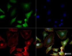 S100A4 Antibody (1F11) - Azide and BSA Free, Novus Biologicals 0.1 mg;
