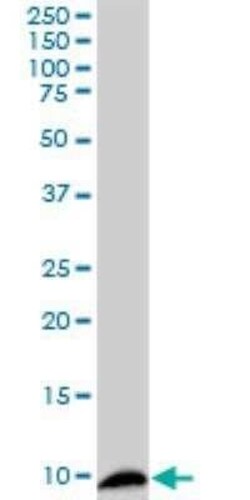 S100A4 Antibody (1F12-1G7), Novus Biologicals 0.1 mg | Buy Online | Novus Biologicals | Fisher Scientific
