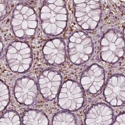 S100A4 Antibody (CL0237), Novus Biologicals 25 &mu;L, Unconjugated:Antibodies,